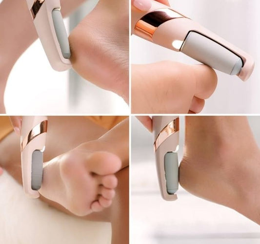 Rechargeable Electric Callus Remover